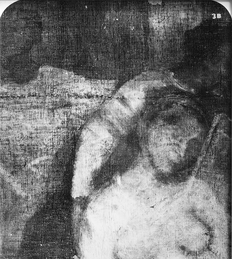 1929_1_xray_3B.jpg